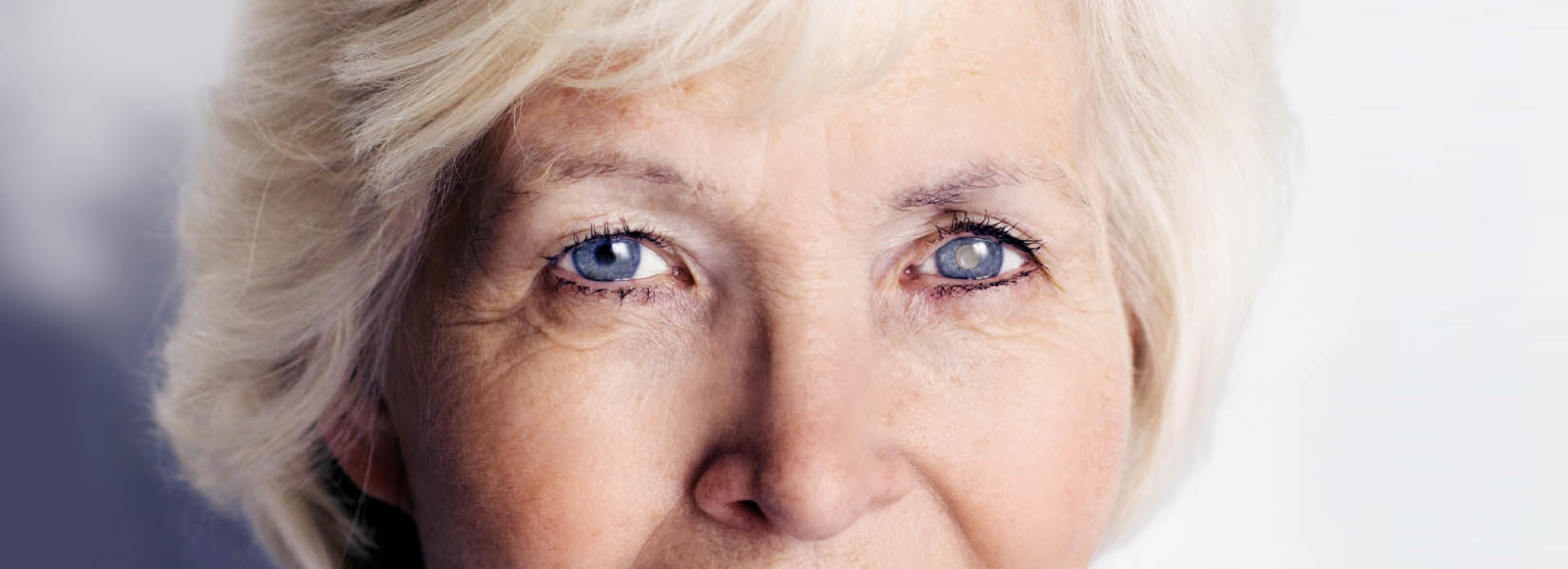 Cataract Surgery in Bethany