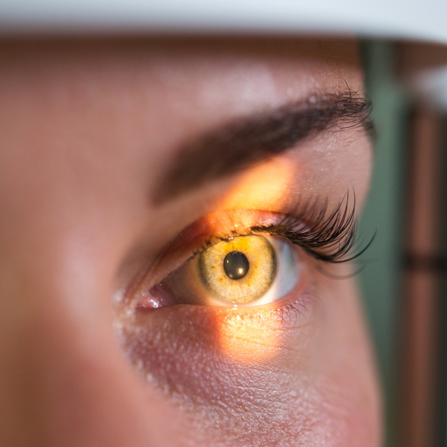 Vision Therapy in Bethany